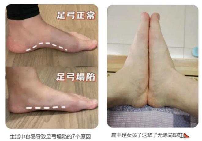 九游娱乐：年轻人捧红日本“足力健”王铁梅也在穿(图3)